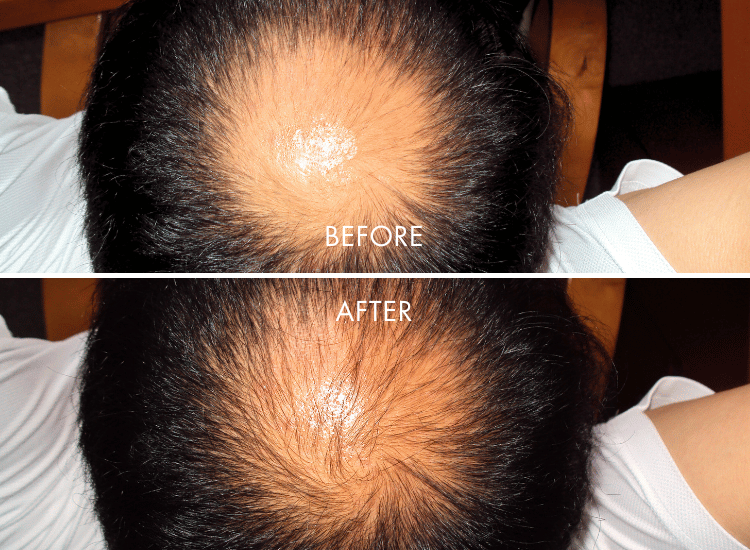 IHAIR-Product_Page_1.png