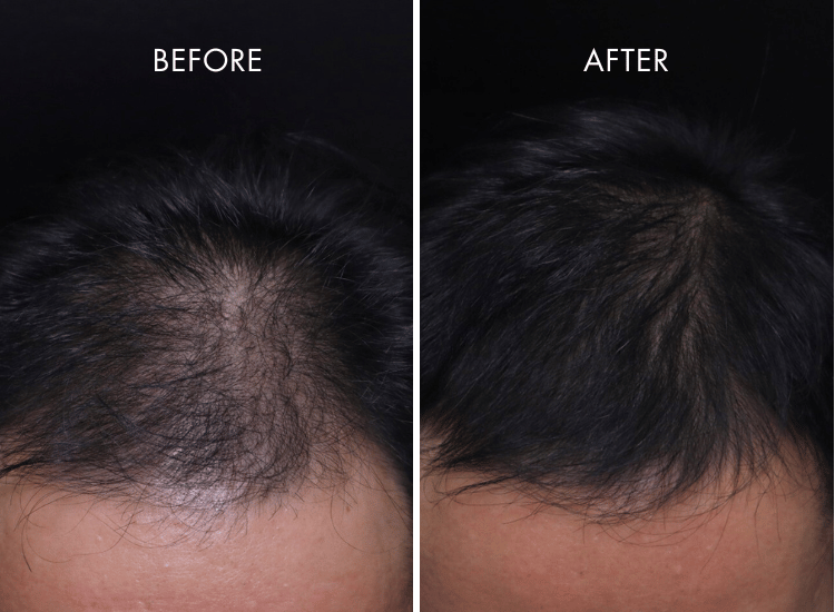 IHAIR-Product_Page_2_8414c59e-d2db-4f7c-8ca4-9ec83bc4475f.png