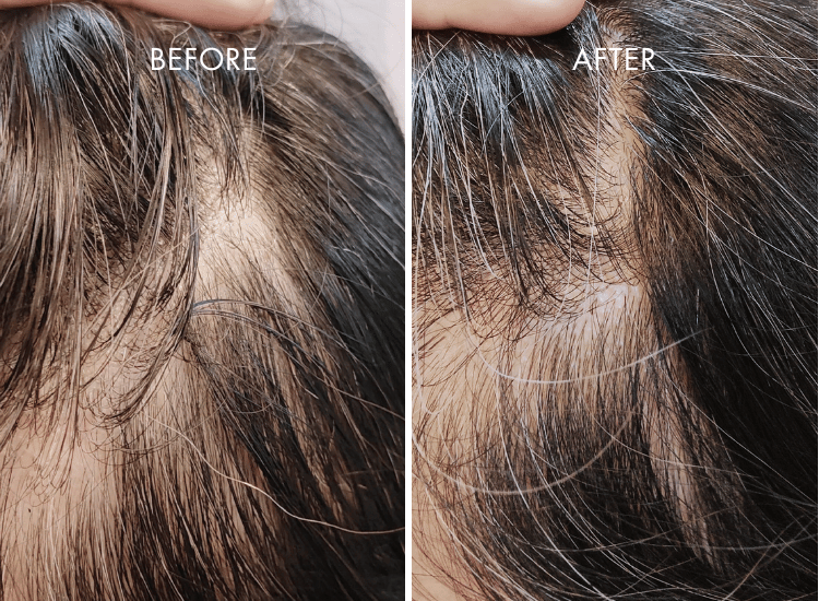 IHAIR-Product_Page_4.png