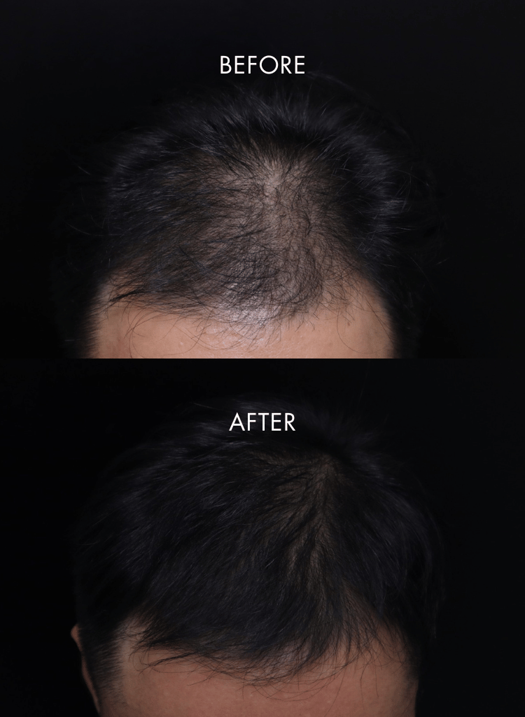 IHAIR_1.png