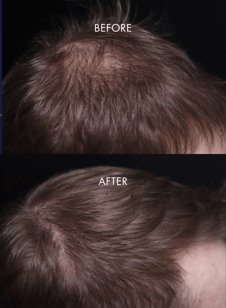 IHAIR_2.png