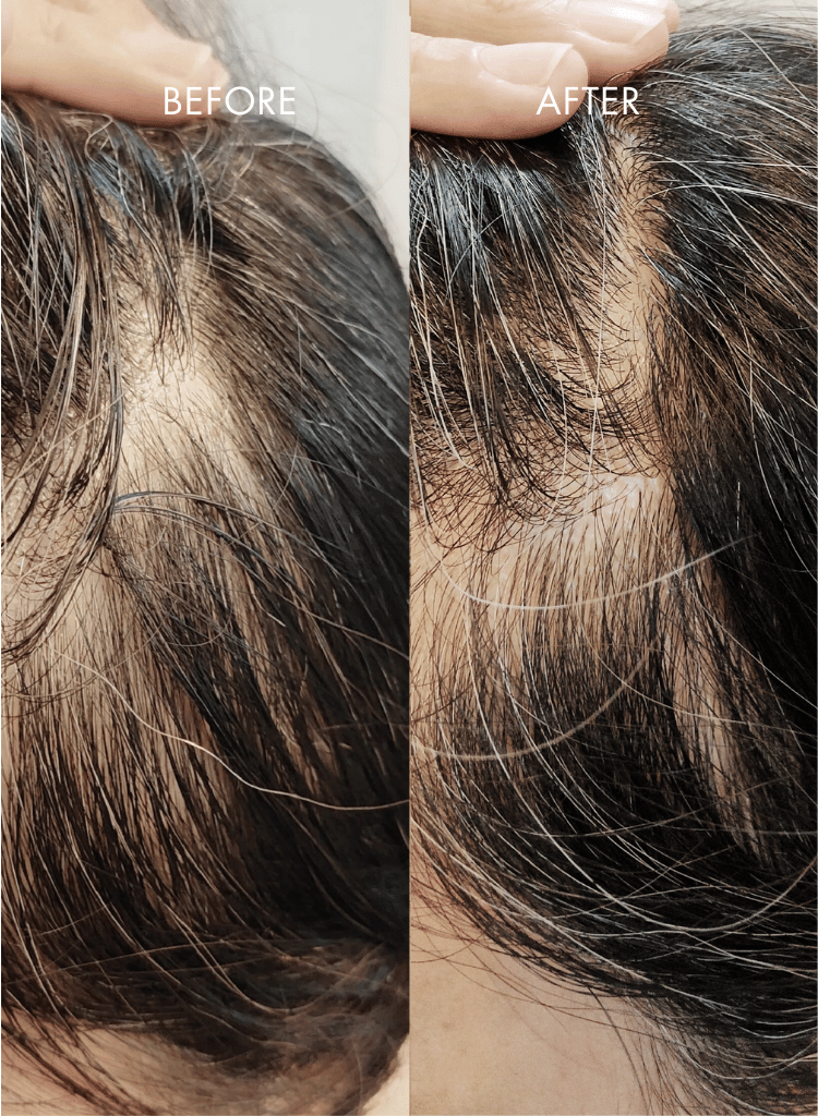 IHAIR_3.png