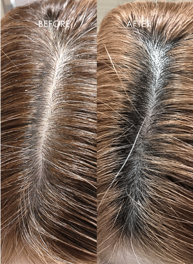 IHAIR_4.png