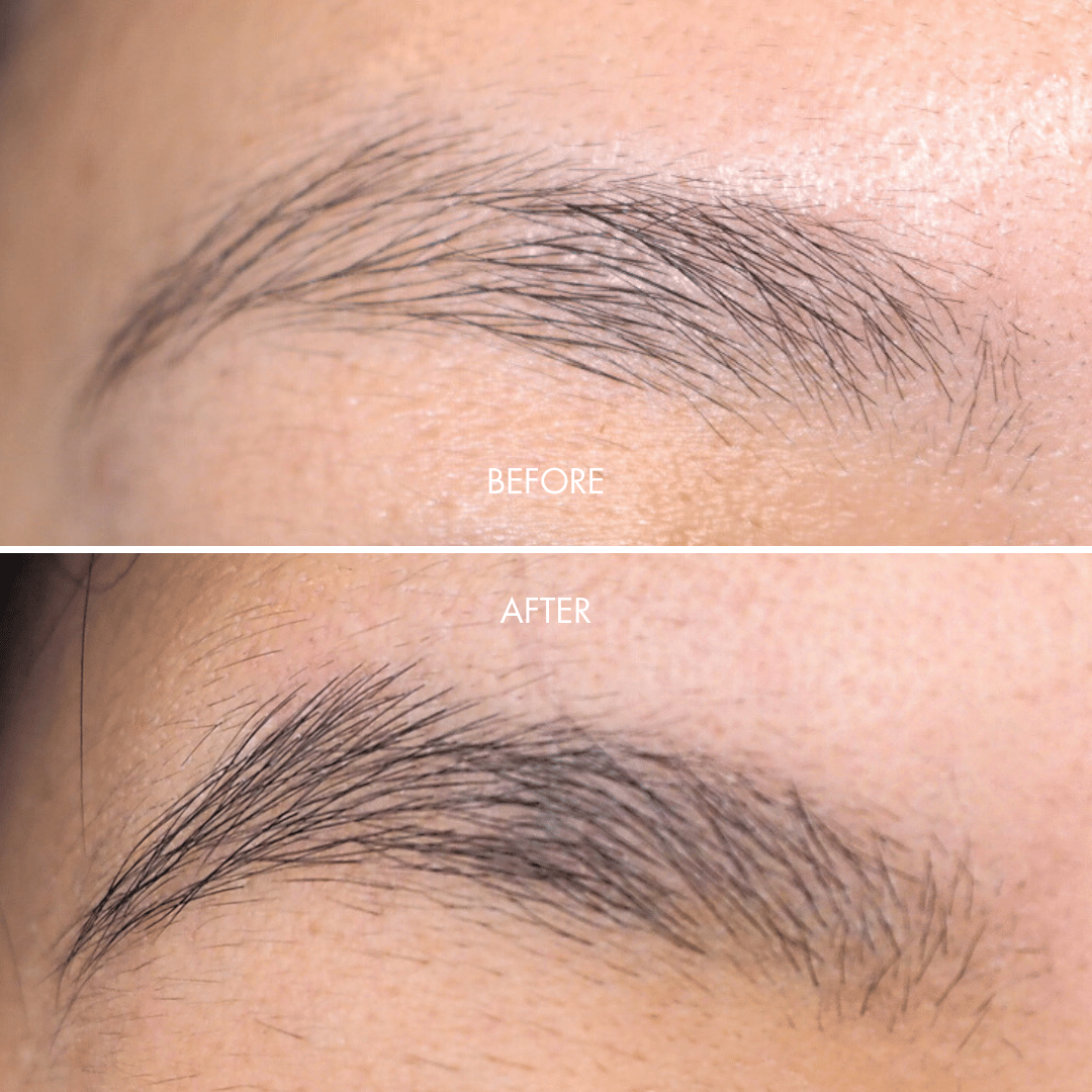 IBROW before and after photo supplied by ILASH Singapore