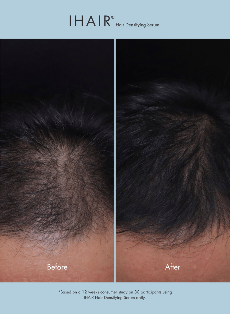 IHAIR Hair Densifying Serum