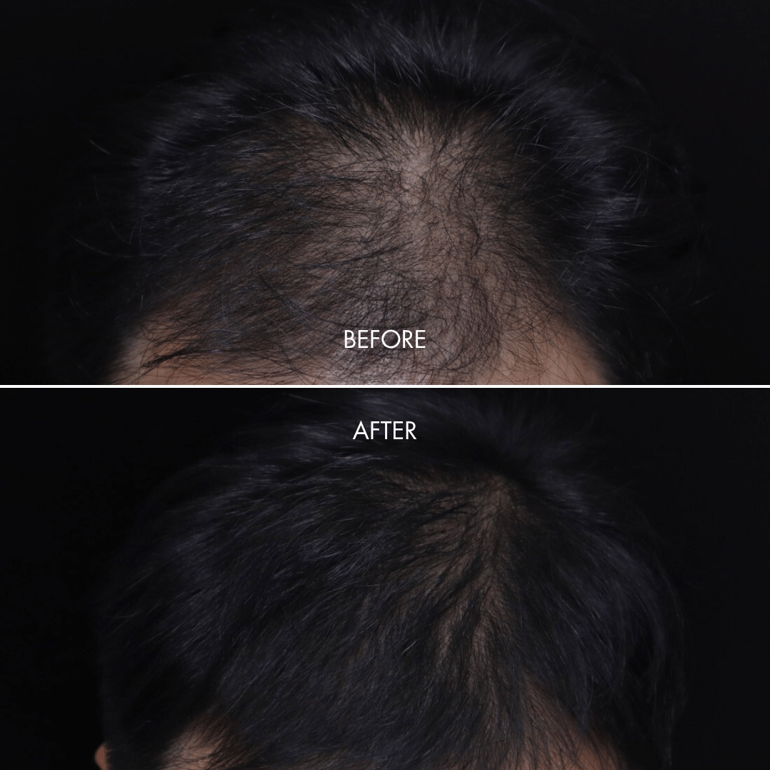 ILASH-IHAIR_Product_Page.png