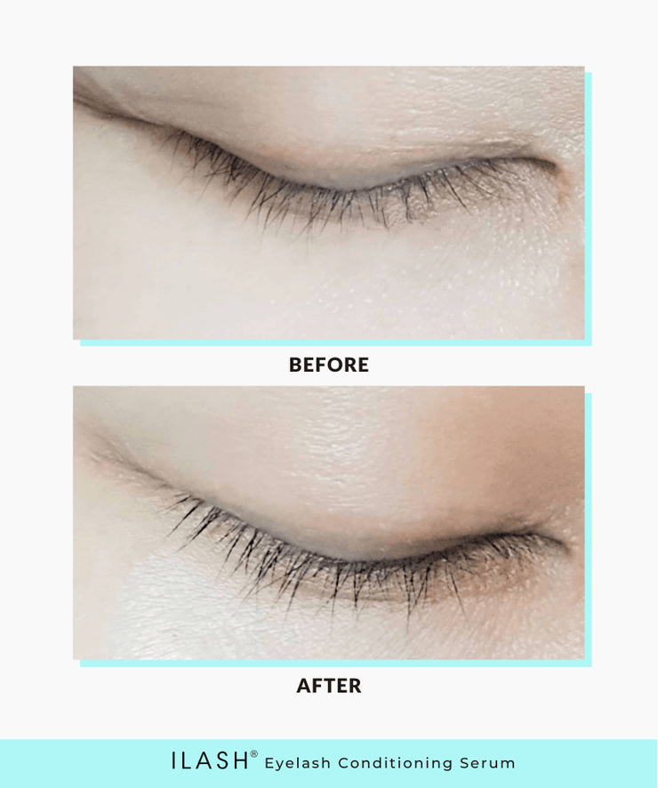 ILASH® Eyelash Conditioning Serum