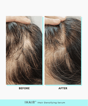 IHAIR® Hair Densifying Serum